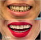 Slider image (10) Luna Dental Clinic